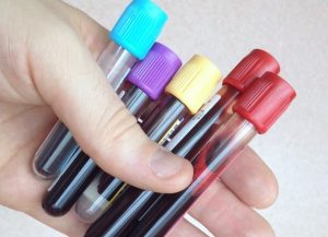 The diagnostic utility of inflammatory markers in primary care: a prospective cohort study (PhD)