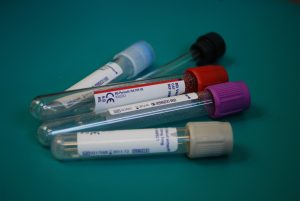 Are common blood tests being optimally used for early cancer diagnosis? (PhD)